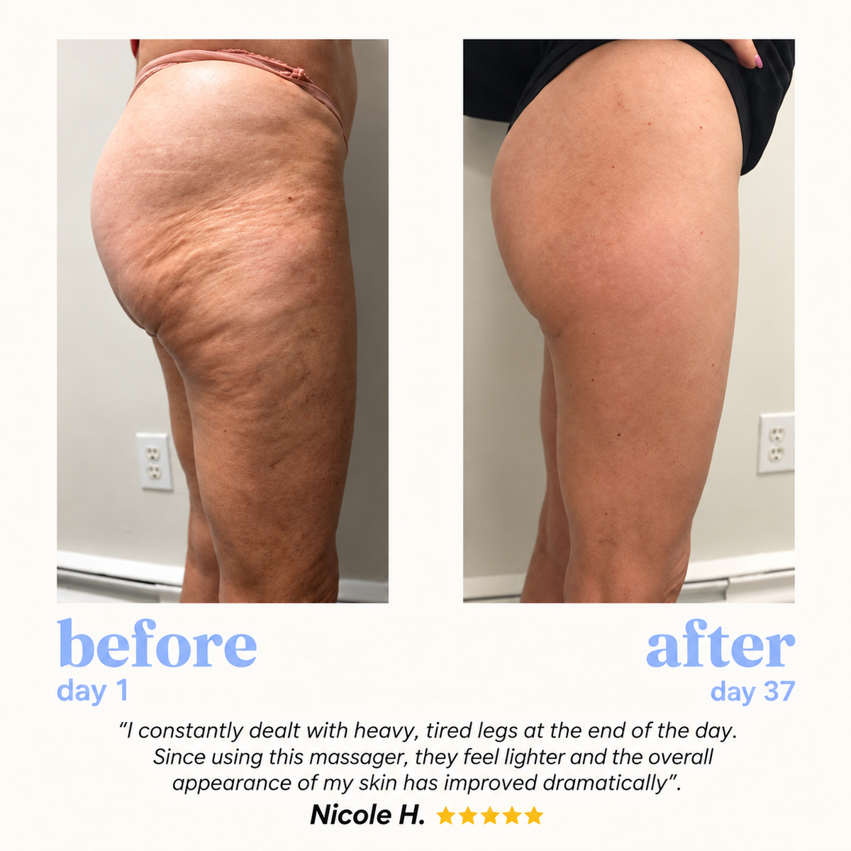 Cellulite & Lymphatic Massager - Drainer