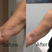 Cryo Thermo Cellulite Gel