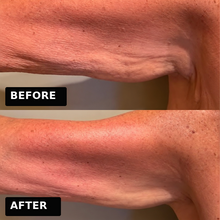 Cryo Thermo Cellulite Gel